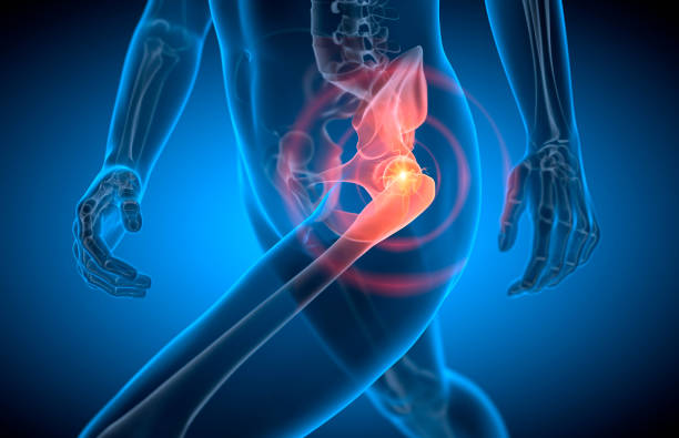 Hip pain treatment in Nagpur