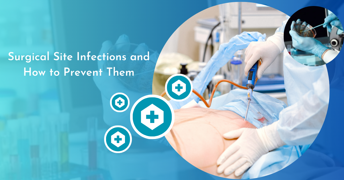 Infection control surgery in nagpur