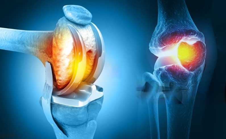Joint Replacement Surgeon In Nagpur