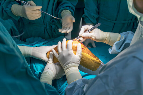 Joint replacement surgeon services in Nagpur