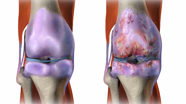 Knee osteoarthritis treatment in Nagpur