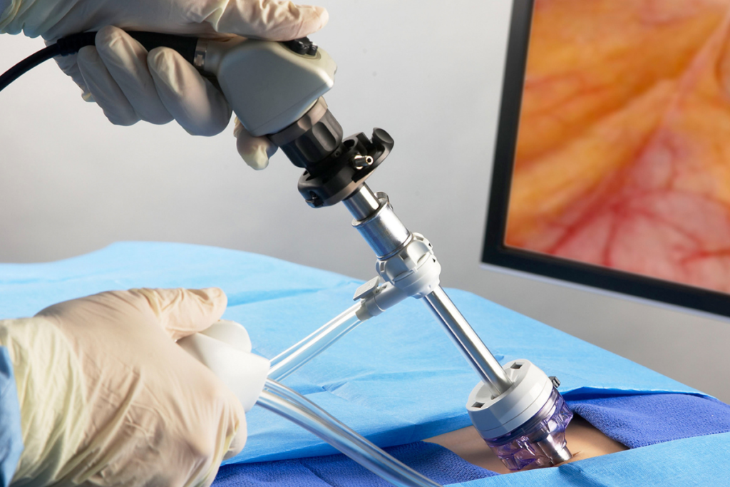 Minimally Invasive Orthopaedic Surgery In Nagpur
