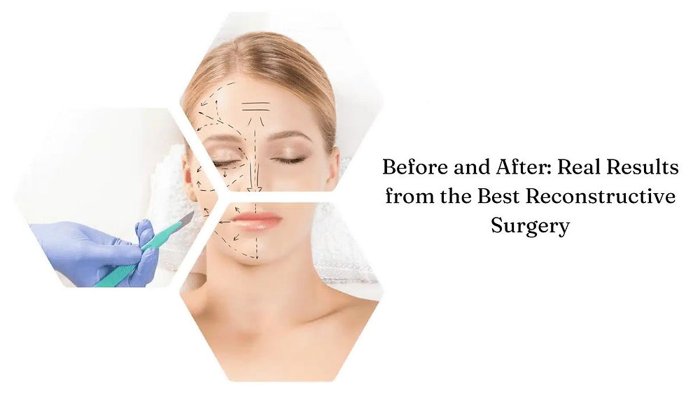 Reconstructive Surgery in Nagpur
