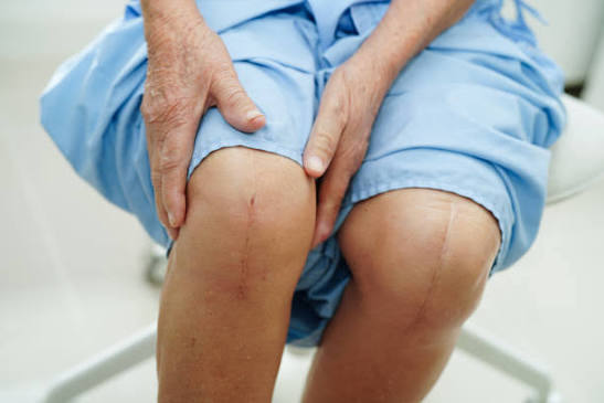 Reduced scar knee surgery in Nagpur