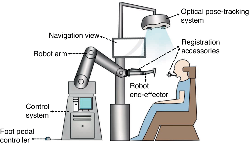 Robotic implant positioning in Nagpur