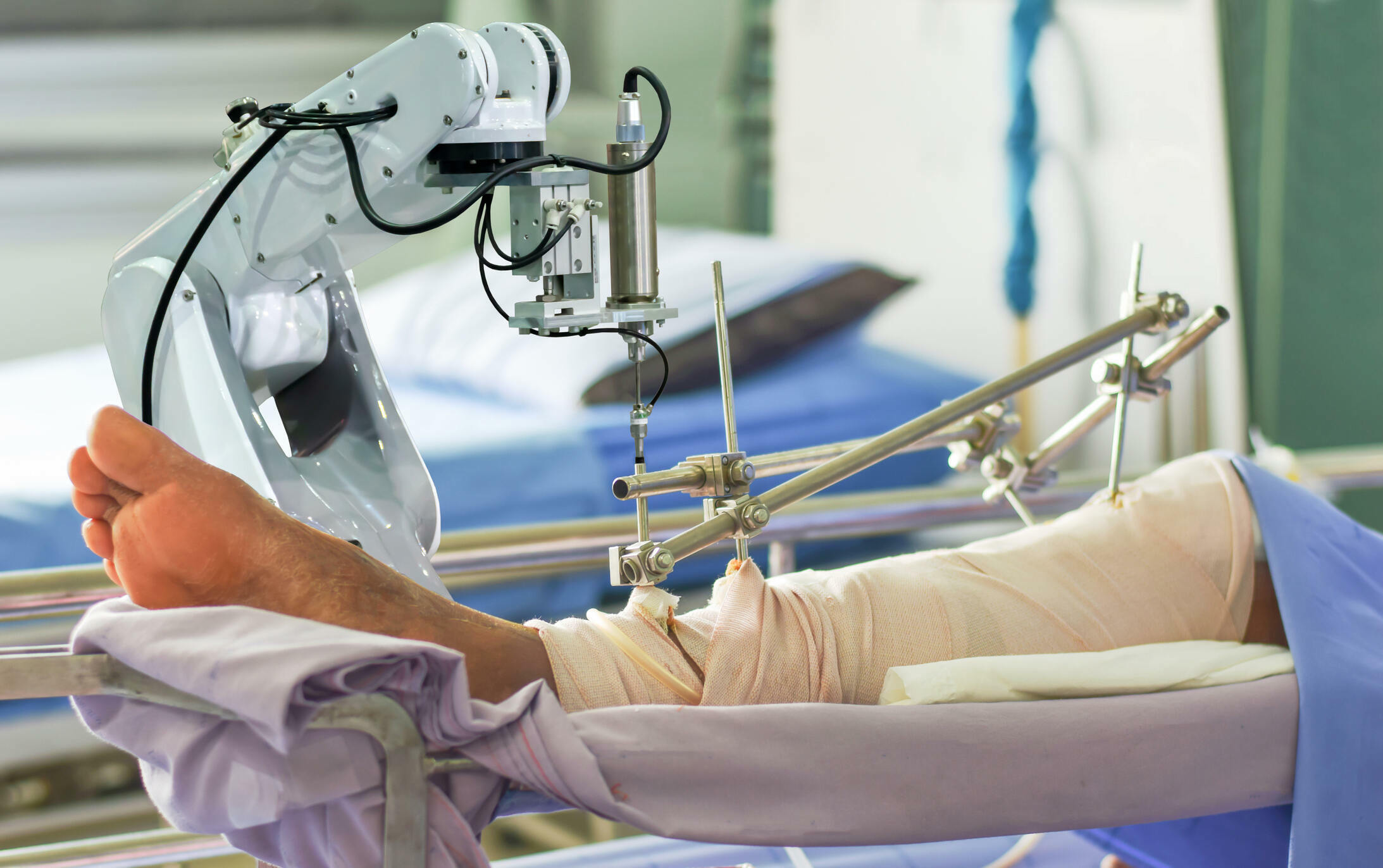 Robotic joint replacement surgery in Nagpur
