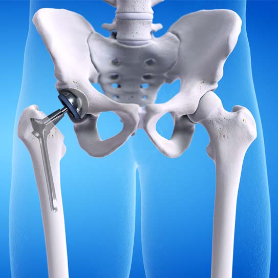 Same-day hip surgery options in Nagpur