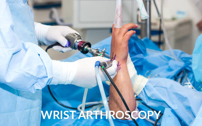 Wrist Arthroscopy In Nagpur